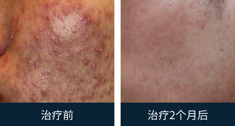 슬라이드 이미지