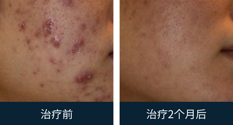 슬라이드 이미지