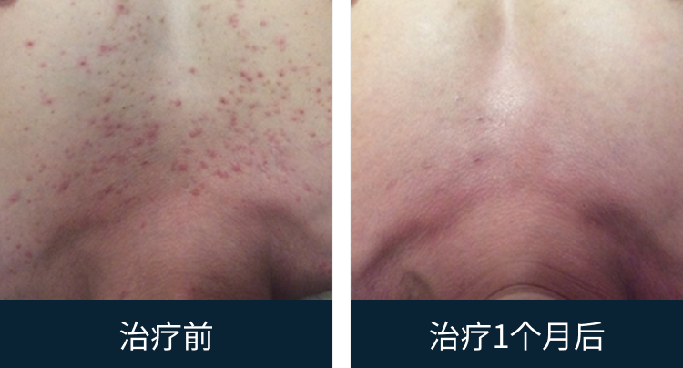 슬라이드 이미지