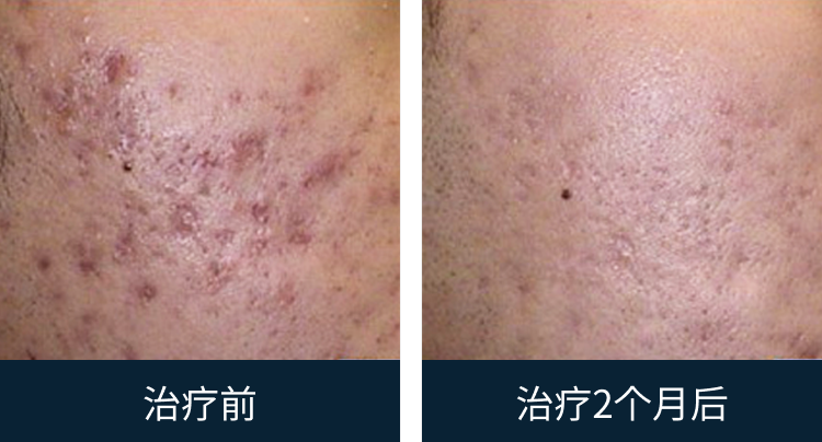 슬라이드 이미지