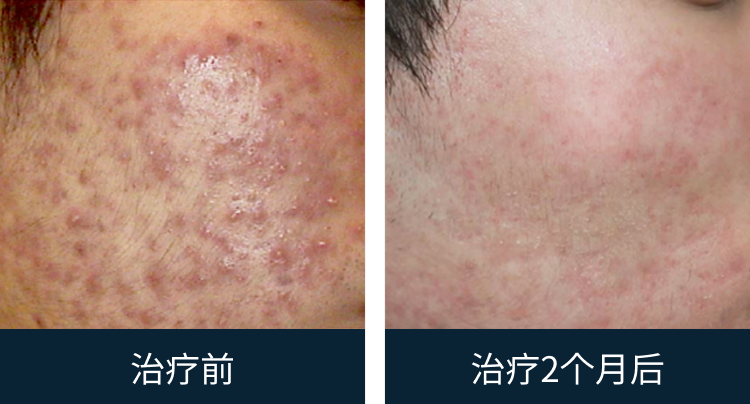 슬라이드 이미지