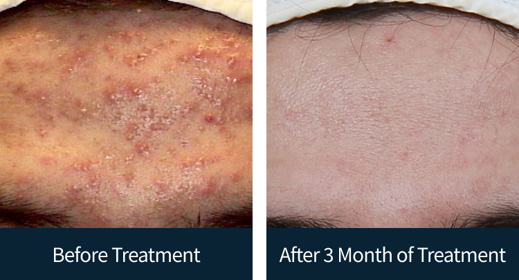 슬라이드 이미지