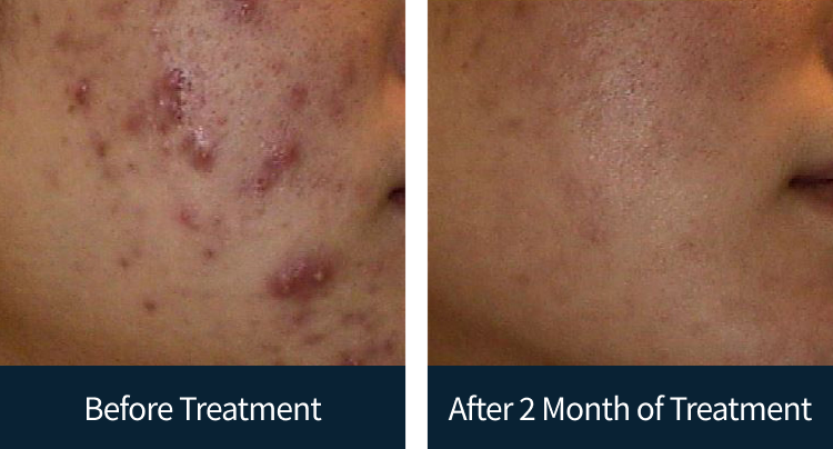 슬라이드 이미지