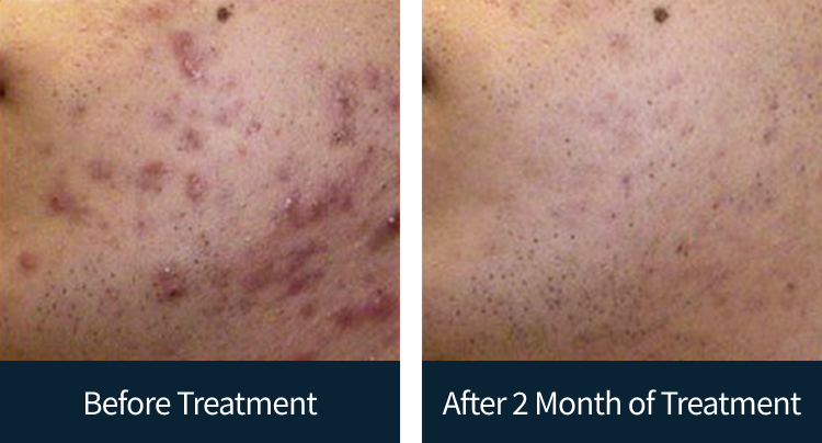 슬라이드 이미지