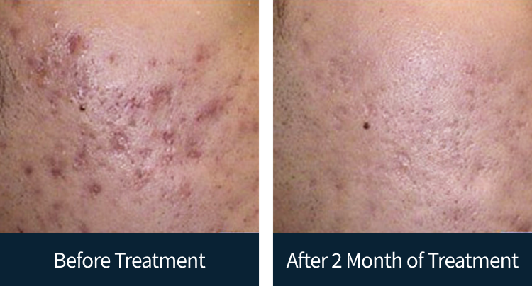 슬라이드 이미지