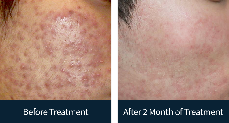 슬라이드 이미지