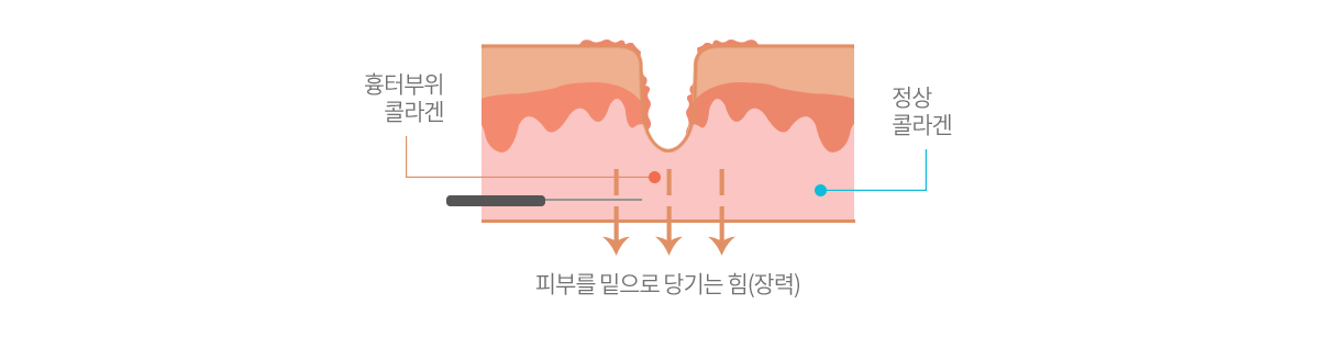 컨텐츠 이미지