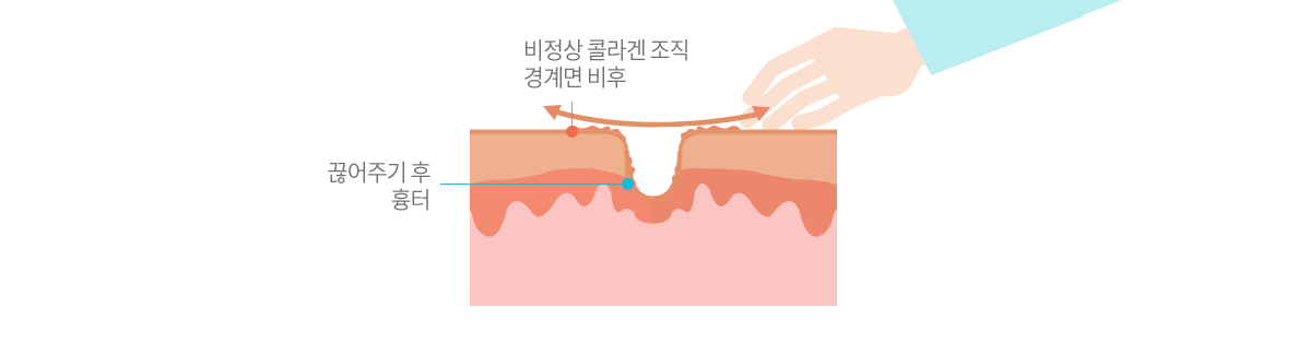 컨텐츠 이미지