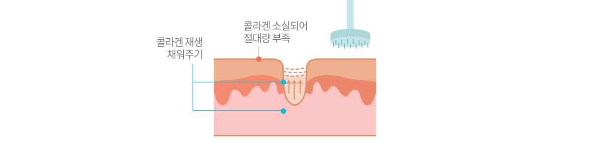 컨텐츠 이미지