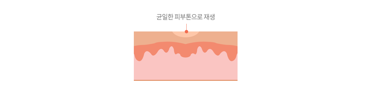 컨텐츠 이미지