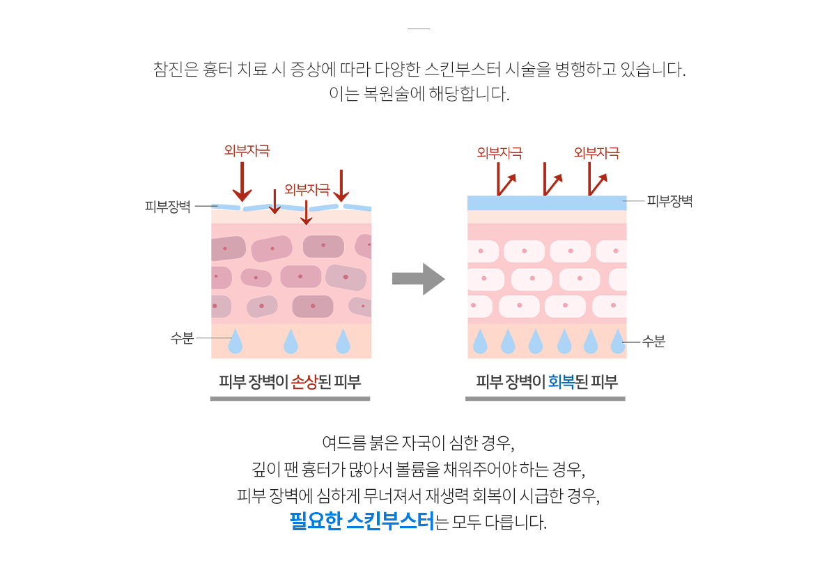 컨텐츠 이미지