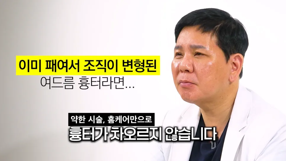 재생크림에도 그대로인 흉터