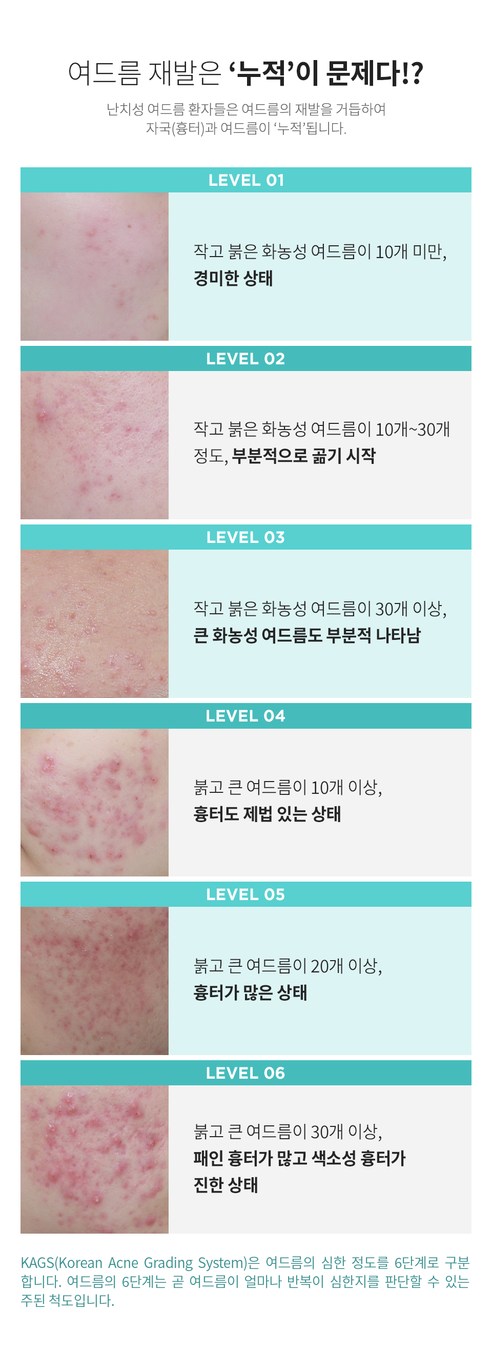 컨텐츠 이미지