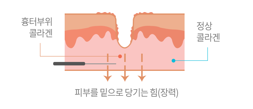 컨텐츠 이미지