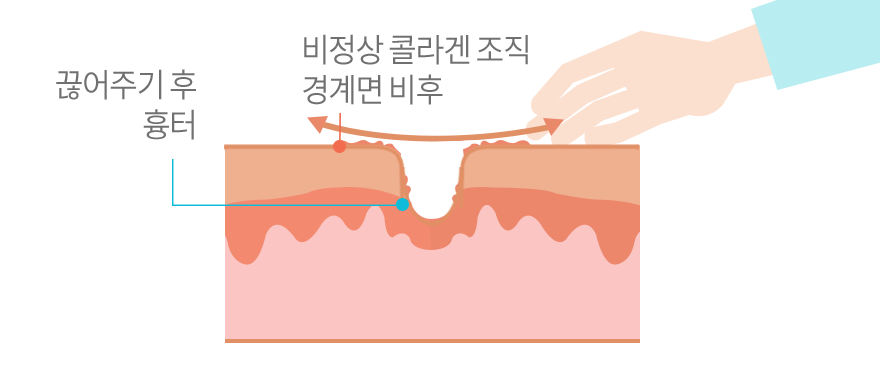 컨텐츠 이미지