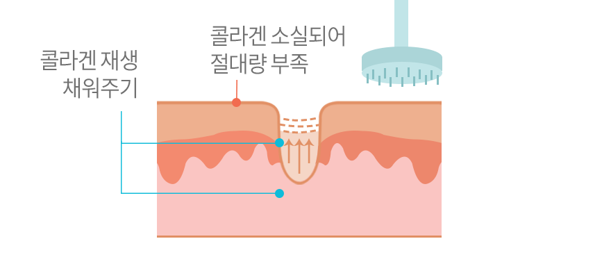 컨텐츠 이미지