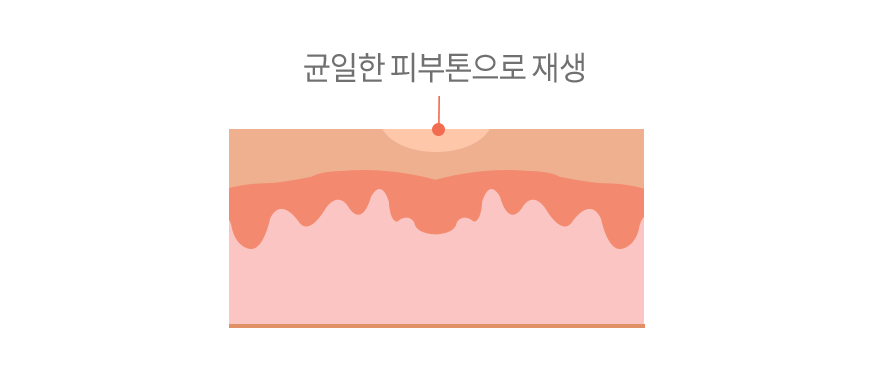 컨텐츠 이미지