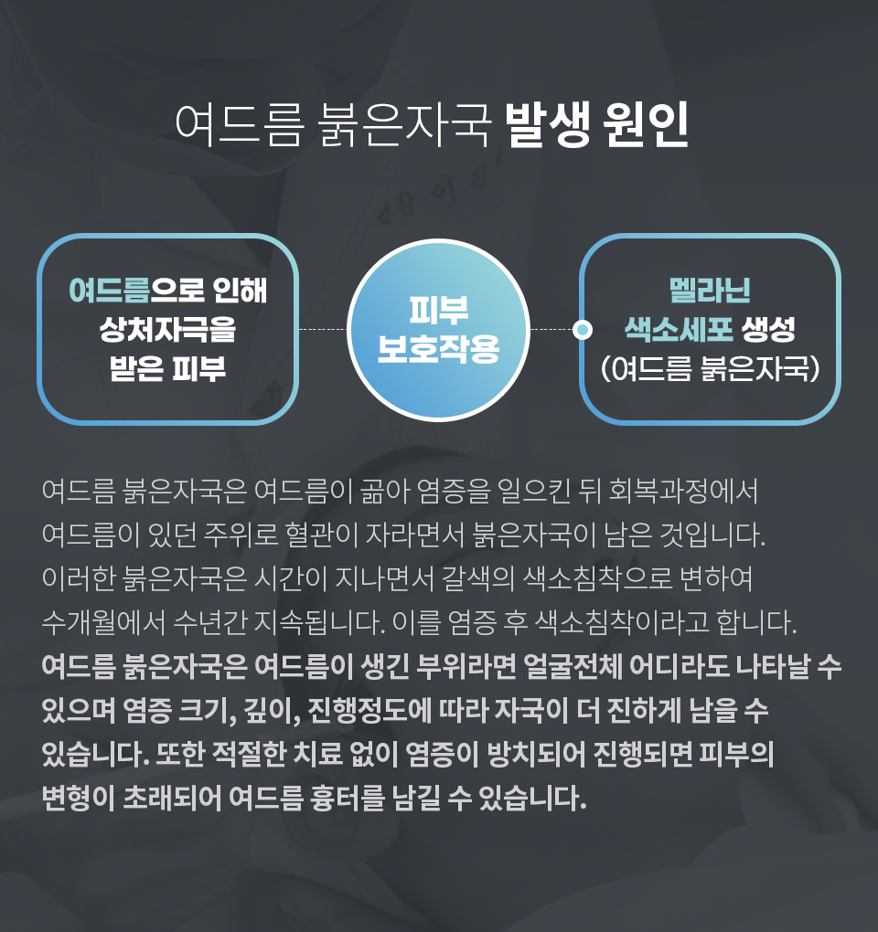 컨텐츠 이미지