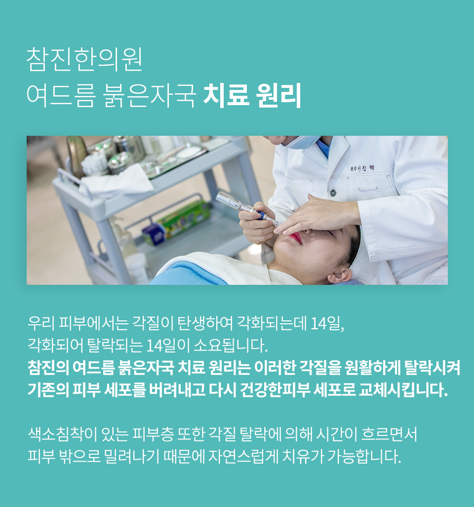 컨텐츠 이미지